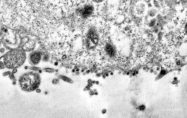 Зроблені фото атаки клітин COVID-19 під мікроскопом