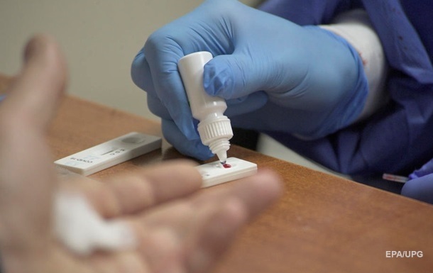 Нідерландська компанія продала 1,5 млн неякісних тестів на коронавірус