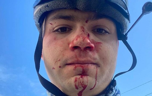 В Киеве избили велосипедиста, помешавшего машине проехать по тротуару