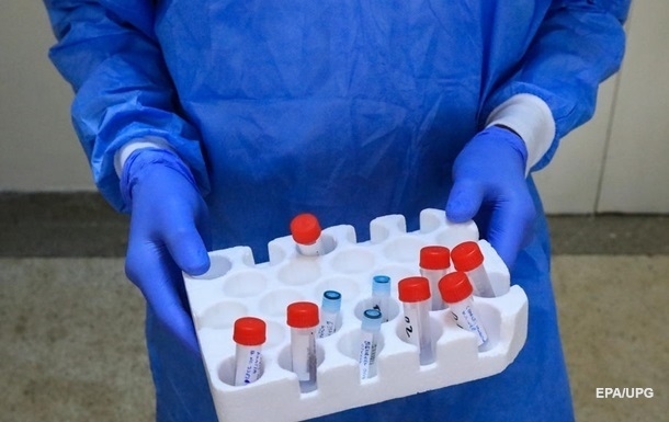 Озвучені підсумки ІФА-тестування на коронавірус в Україні