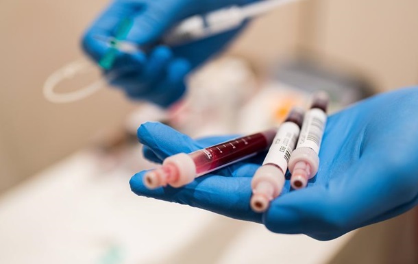 Нові дослідження коронавірусу: довести наявність антитіл не так просто