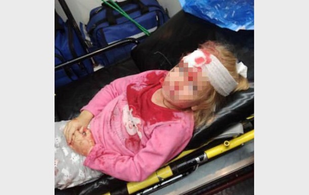 Протести в Білорусі: у Гродні постраждала п ятирічна дівчинка