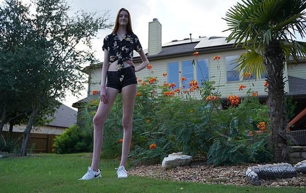 У США у дівчини найдовші ноги у світі