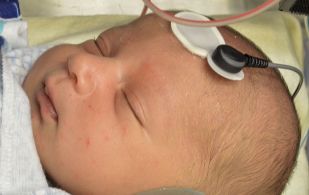 Вчені запропонували новий метод для діагностики аутизму в новонароджених