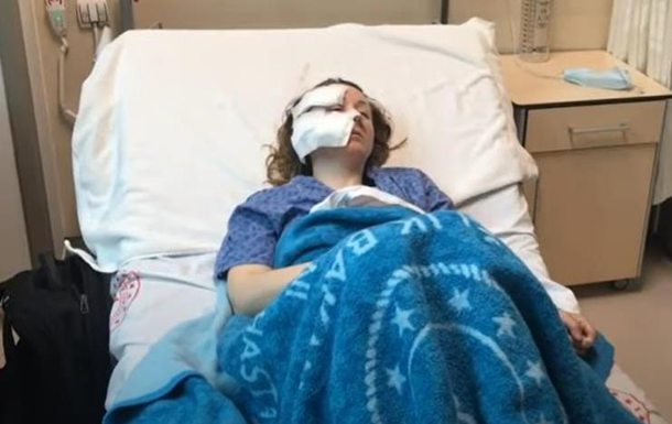 В Турции бывший муж изрезал ножом лицо украинке