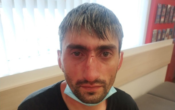 В Киеве избили антимайдановца  Топаза 