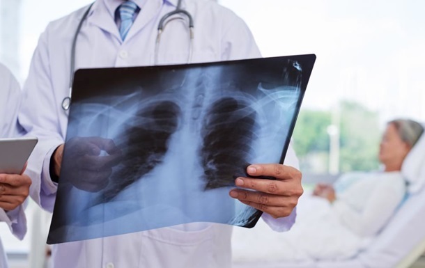 Медики порівняли легені щепленого і нещепленого COVID-хворих