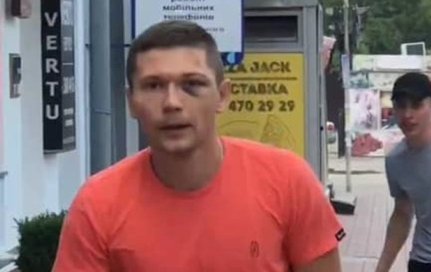 Співробітник УДО, який побив танцюриста Дорофеєвої, постане перед судом