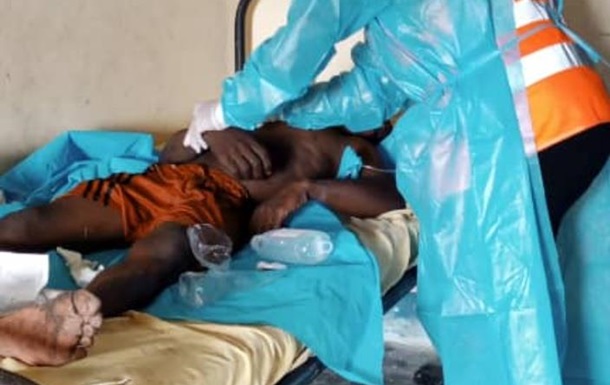 П ятеро людей стали жертвами спалаху холери у Камеруні