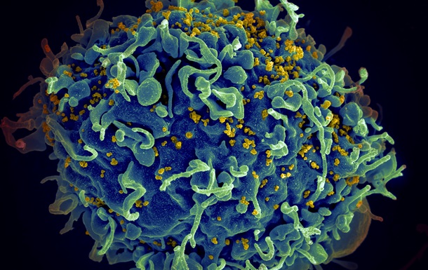 У Японії вчені успішно випробували вакцину від ВІЛ