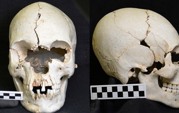 На безлюдному острові виявили 200-річний череп прокаженого