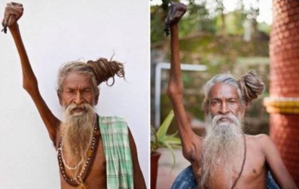 Житель Індії прожив півстоліття з піднятою рукою