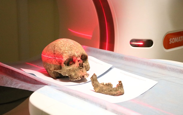 В Тернополе изучают череп возрастом три тысячи лет