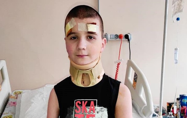 В Украине провели уникальную операцию для спасения 11-летнего мальчика