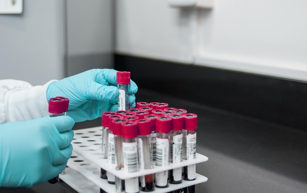 Канадські вчені знайшли метод зміни групи крові