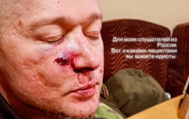 Соліст Бумбокса Хлівнюк поранений під обстрілом у Києві