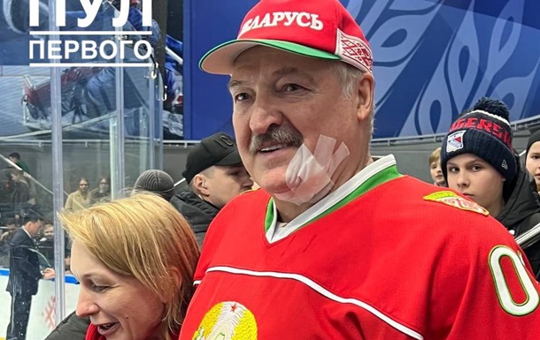 Лукашенко получил клюшкой по лицу