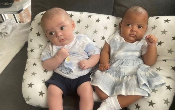 Британка народила близнюків з різним кольором шкіри