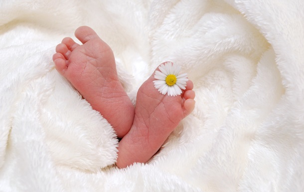 Фото немовляти з вовчою пащею стали вірусними у Мережі