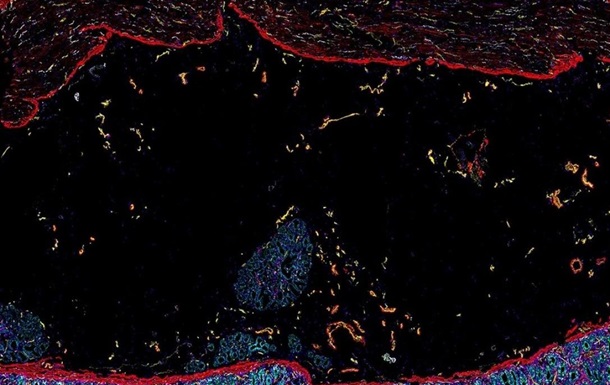 Вчені показали детальну карту людського кишківника