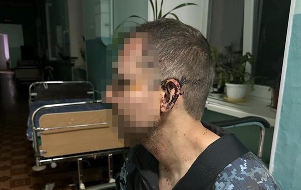 В Одесской области в воинской части избили бойца