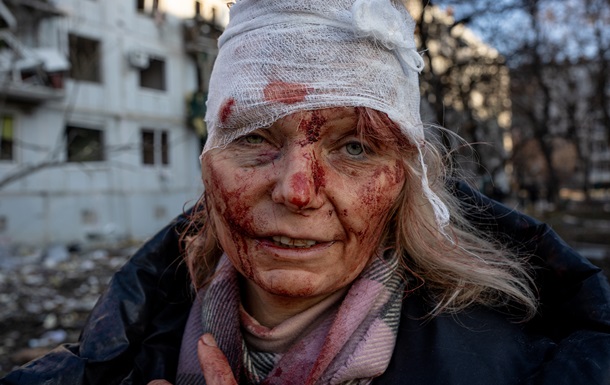 Photos about the war in Ukraine won the International Photography Awards-2023