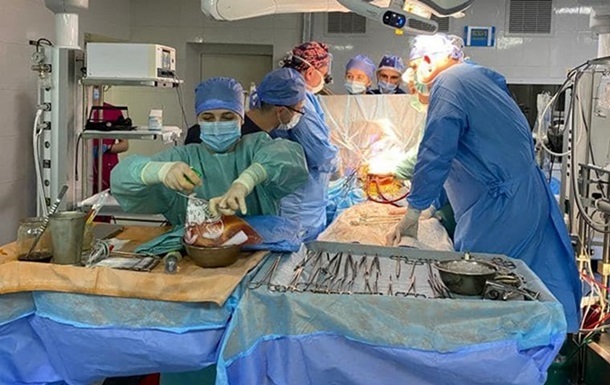 З початку року в Україні провели понад 400 пересадок органів