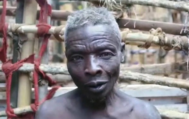 A 55 year old Man Lives In Isolation Because Of His Fear Of Women 