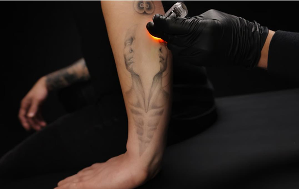 Созданы чернила для тату, которые легко удалить из кожи