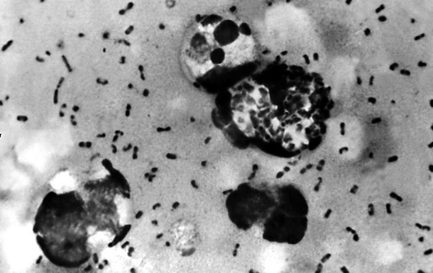 У США виявили перший випадок бубонної чуми за 10 років 
