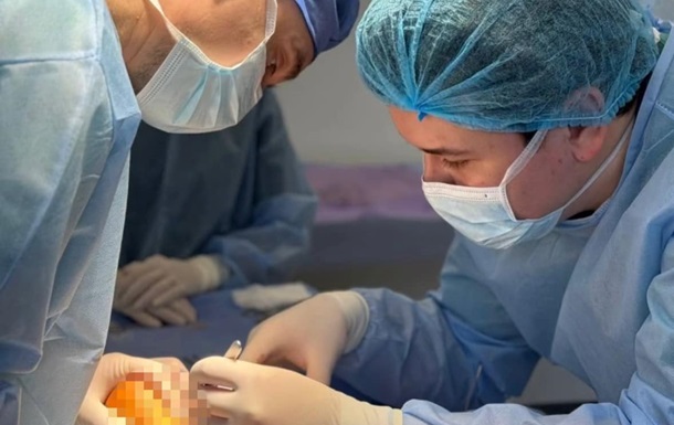 Львівські лікарі видалили велетенську пухлину і врятували волонтеру ногу