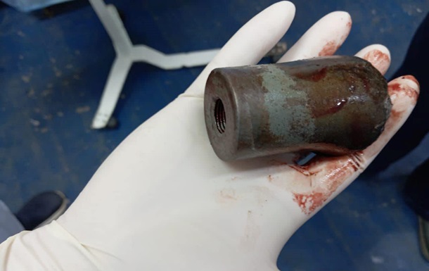 Лікарі вилучили з ноги бійця частину касетного боєприпасу