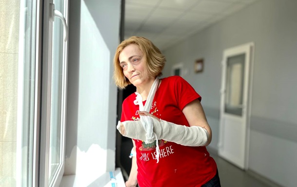 Львівські лікарі провели унікальну операцію жінці, в якої зрослися пальці