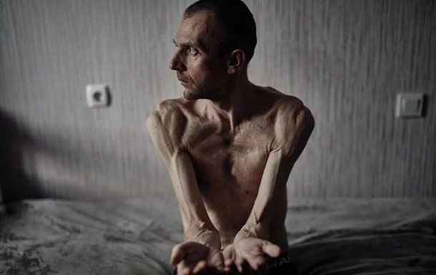 Фотографы показали снимки украинских пленных