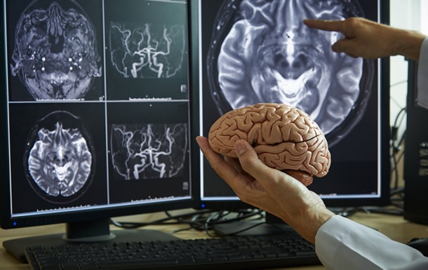 Вчені виявили унікальні зміни в мозку у людей з фобіями