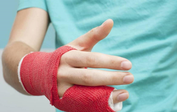 На Рівненщині підлітки постраждали внаслідок вибуху батарейки та петарди