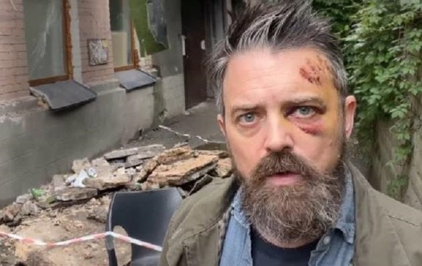 У Києві на американця впав балкон - КМВА