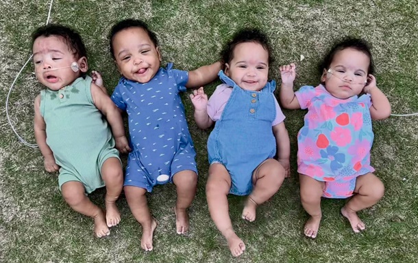 В США народилась найпередчасніша четвірня в історії