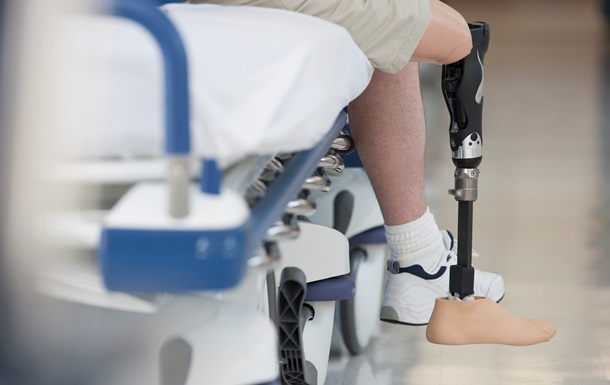 Саудівська Аравія запустила п’ятий етап протезування українців