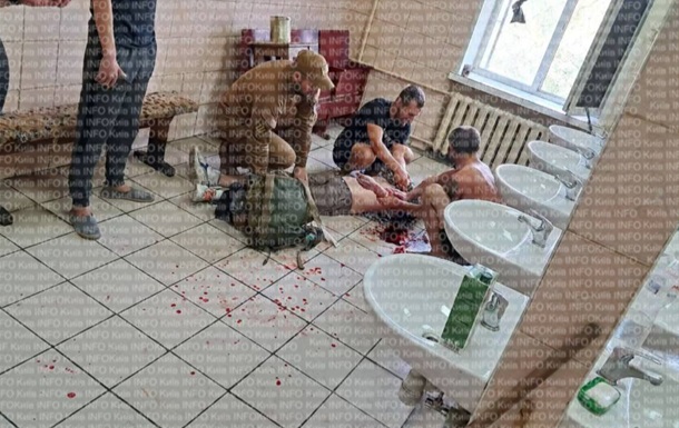 В Киеве мобилизованный порезал себе руки и шею на сборном пункте