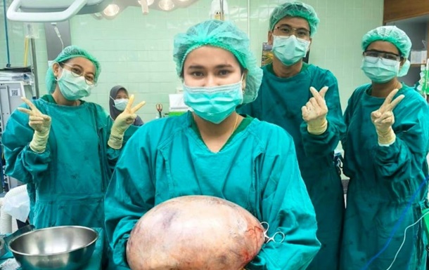 В Таїланді лікарі видалили 8-кілограмову кісту