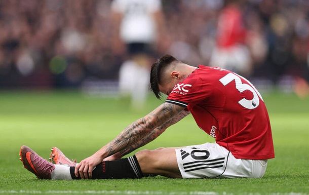 Травмований Шешко пропустить матчі МЮ та збірної