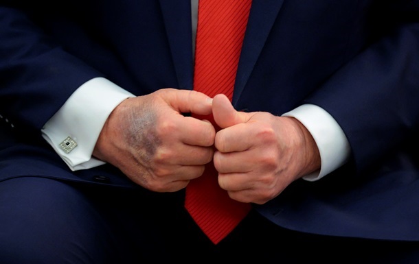 Трамп розповів, звідки у нього синці на руках