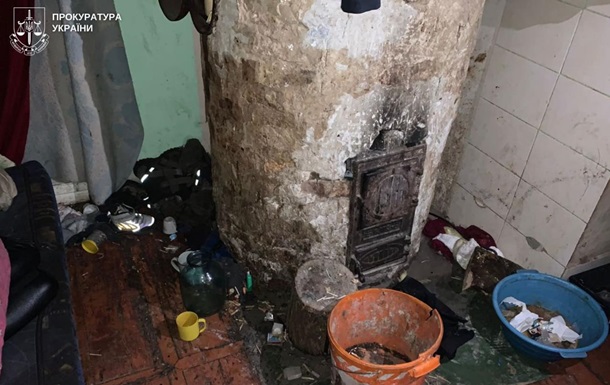 На Львовщине 2-летний мальчик умер в результате критической нехватки ухода