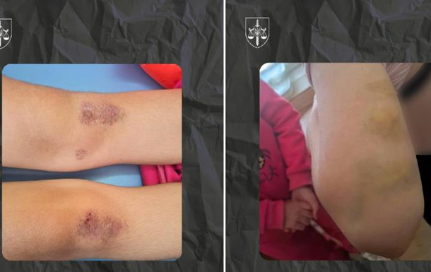 На Полтавщині опікунка катувала молодших сестер