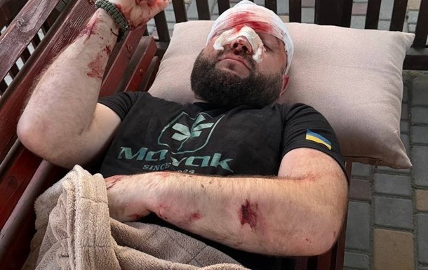 На Одещині жорстоко побили військового за зауваження про російську музику