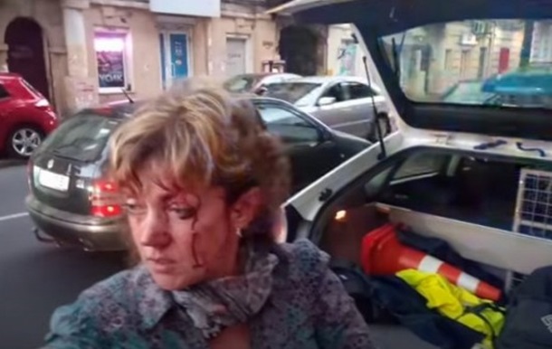 В Одесі побили проукраїнську активістку