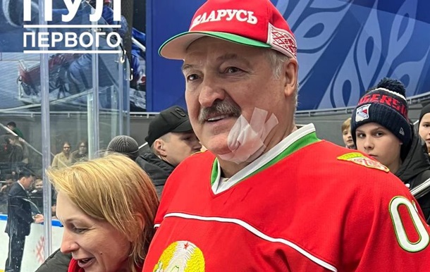 Лукашенко отримав ключкою по обличчю