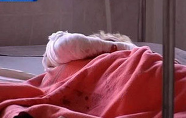 Стан жорстоко побитої в Миколаєві дівчини залишається стабільно важким